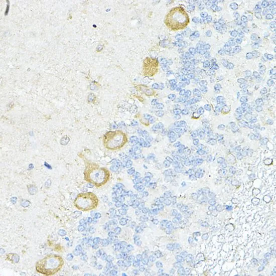 IHC-P analysis of rat cerebellum tissue using GTX66471 RPL10A antibody. Dilution : 1:100