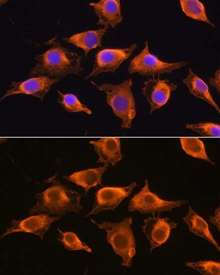 ICC/IF analysis of L929 cells using GTX66474 ZCCHC11 antibody. Blue : DAPI Dilution : 1:100