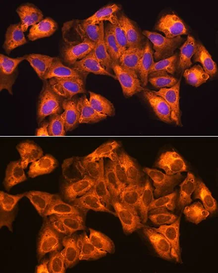 ICC/IF analysis of U2OS cells using GTX66474 ZCCHC11 antibody. Blue : DAPI Dilution : 1:100