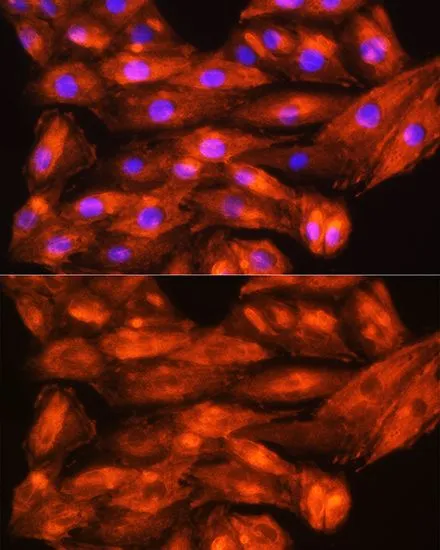 ICC/IF analysis of H9C2 cells using GTX66474 ZCCHC11 antibody. Blue : DAPI Dilution : 1:100