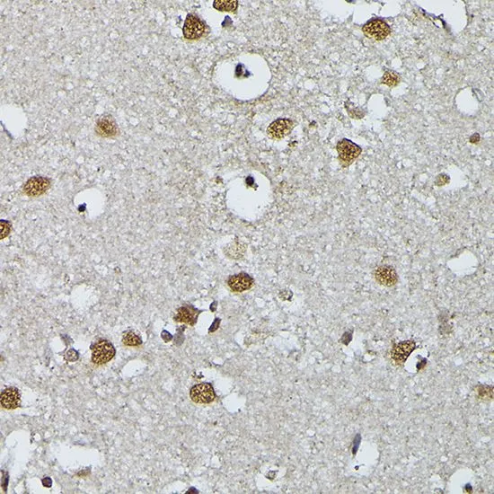 IHC-P analysis of human brain tissue using GTX66476 PRPF4 antibody. Dilution : 1:200