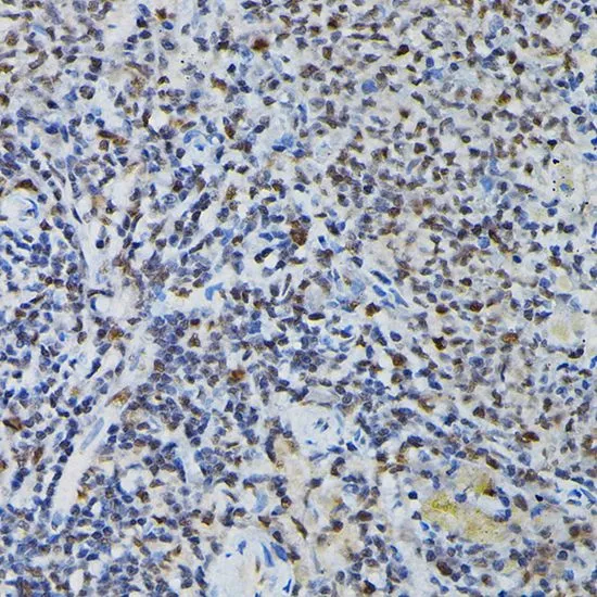 IHC-P analysis of mouse spleen tissue using GTX66476 PRPF4 antibody. Dilution : 1:200