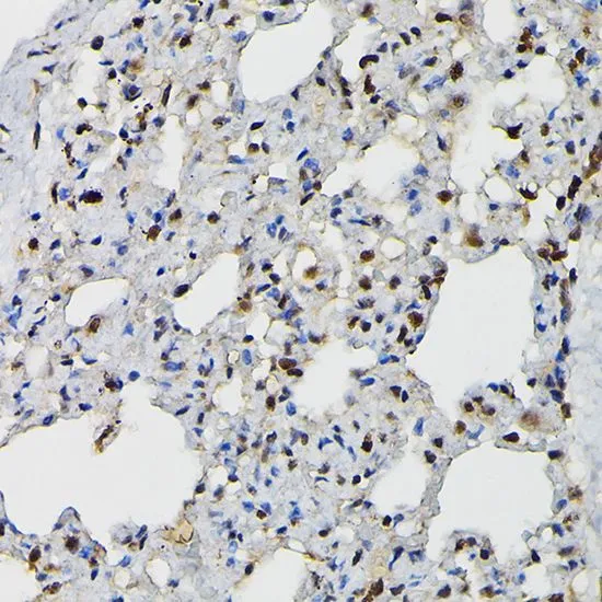 IHC-P analysis of rat lung tissue using GTX66476 PRPF4 antibody. Dilution : 1:200