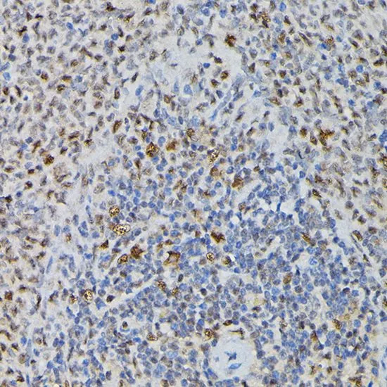 IHC-P analysis of rat spleen tissue using GTX66476 PRPF4 antibody. Dilution : 1:200