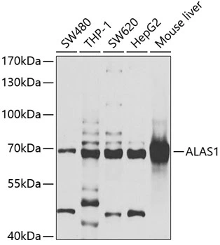 WB analysis of various sample lysates using GTX66478 ALAS-H antibody. Dilution : 1:1000 Loading : 25microg per lane