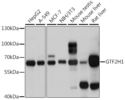 WB analysis of various sample lysates using GTX66483 GTF2H1 antibody. Dilution : 1:1000 Loading : 25microg per lane WB analysis of various sample lysates using GTX66483 GTF2H1 antibody. Dilution : 1:1000 Loading : 25microg per lane