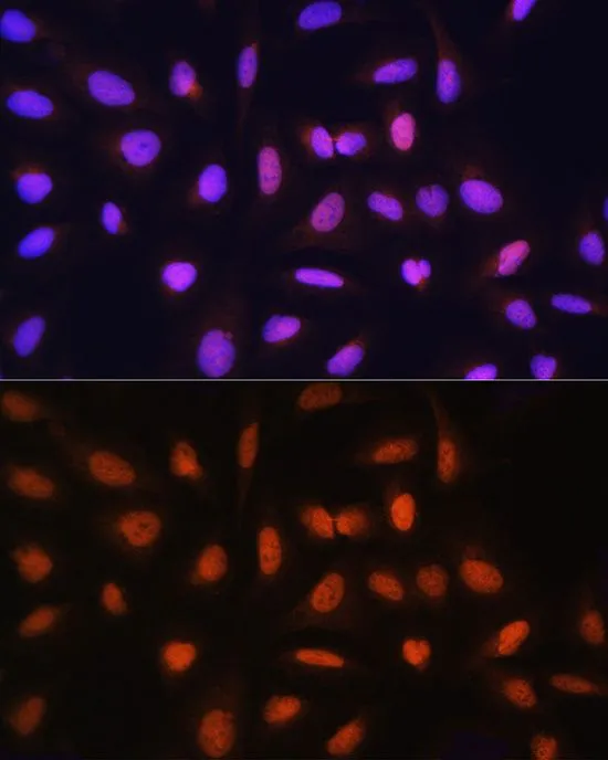 ICC/IF analysis of U2OS cells using GTX66483 GTF2H1 antibody. Blue : DAPI Dilution : 1:100