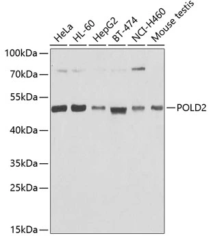 WB analysis of various sample lysates using GTX66484 POLD2 antibody. Dilution : 1:1000 Loading : 25microg per lane WB analysis of various sample lysates using GTX66484 POLD2 antibody. Dilution : 1:1000 Loading : 25microg per lane