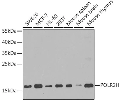 WB analysis of various sample lysates using GTX66488 RPB8 antibody. Dilution : 1:1000 Loading : 25microg per lane