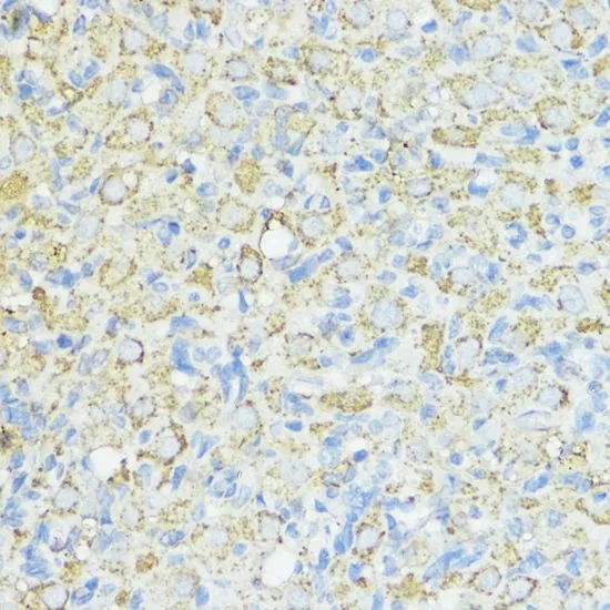 IHC-P analysis of rat ovary tissue using GTX66490 SOD3 antibody. Dilution : 1:100