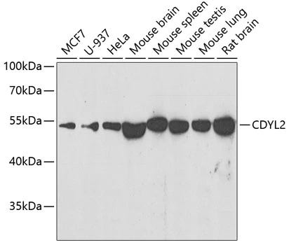 WB analysis of various sample lysates using GTX66493 CDYL2 antibody. Dilution : 1:500 Loading : 25microg per lane WB analysis of various sample lysates using GTX66493 CDYL2 antibody. Dilution : 1:500 Loading : 25microg per lane