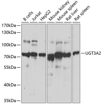 WB analysis of various sample lysates using GTX66500 UGT3A2 antibody. Dilution : 1:1000 Loading : 25microg per lane WB analysis of various sample lysates using GTX66500 UGT3A2 antibody. Dilution : 1:1000 Loading : 25microg per lane