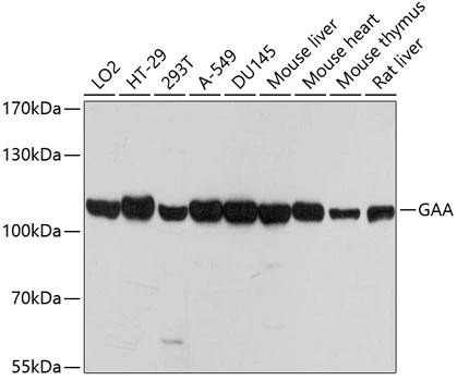 WB analysis of various sample lysates using GTX66501 LYAG antibody. Dilution : 1:1000 Loading : 25microg per lane WB analysis of various sample lysates using GTX66501 LYAG antibody. Dilution : 1:1000 Loading : 25microg per lane