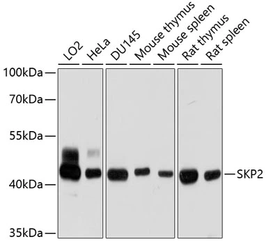 WB analysis of various sample lysates using GTX66503 SKP2 antibody. Dilution : 1:1000 Loading : 25microg per lane WB analysis of various sample lysates using GTX66503 SKP2 antibody. Dilution : 1:1000 Loading : 25microg per lane