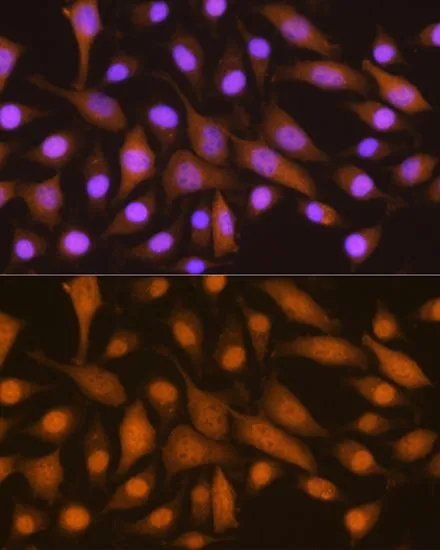 ICC/IF analysis of L929 cells using GTX66503 SKP2 antibody. Blue : DAPI Dilution : 1:100