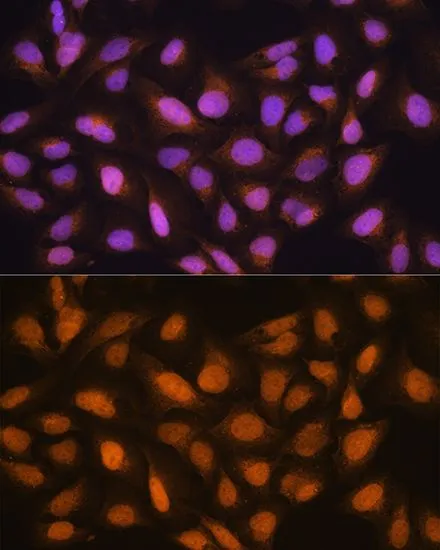 ICC/IF analysis of U2OS cells using GTX66503 SKP2 antibody. Blue : DAPI Dilution : 1:100