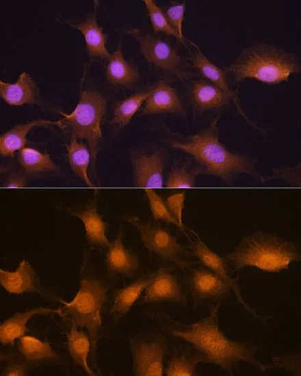 ICC/IF analysis of C6 cells using GTX66503 SKP2 antibody. Blue : DAPI Dilution : 1:100