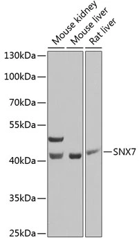 WB analysis of various sample lysates using GTX66504 SNX7 antibody. Dilution : 1:1000 Loading : 25microg per lane WB analysis of various sample lysates using GTX66504 SNX7 antibody. Dilution : 1:1000 Loading : 25microg per lane