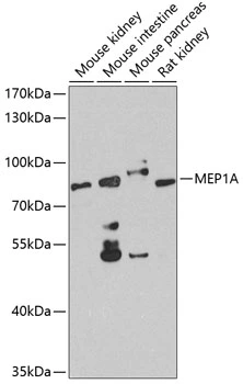 WB analysis of various sample lysates using GTX66511 Meprin alpha antibody. Dilution : 1:1000 Loading : 25microg per lane WB analysis of various sample lysates using GTX66511 Meprin alpha antibody. Dilution : 1:1000 Loading : 25microg per lane