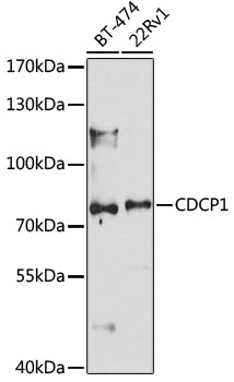 WB analysis of various sample lysates using GTX66513 CDCP1 antibody. Dilution : 1:1000 Loading : 25microg per lane