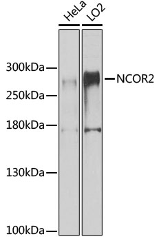 WB analysis of extracts of various cell lines using GTX66517 SMRT antibody. Loading : 25ug per lane Dilution : 1:1000