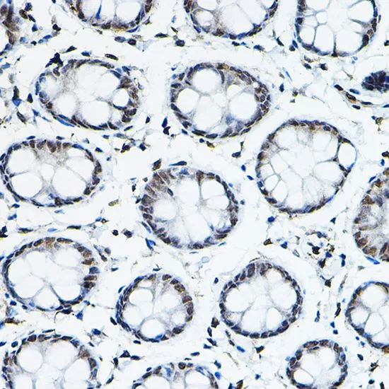 IHC-P analysis of human colon tissue using GTX66517 SMRT antibody. Dilution : 1:100