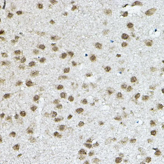 IHC-P analysis of mouse brain tissue using GTX66517 SMRT antibody. Dilution : 1:100