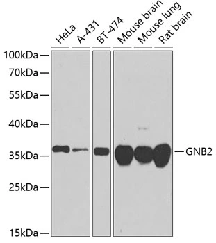 WB analysis of various sample lysates using GTX66519 GNB2 antibody. Dilution : 1:1000 Loading : 25microg per lane WB analysis of various sample lysates using GTX66519 GNB2 antibody. Dilution : 1:1000 Loading : 25microg per lane