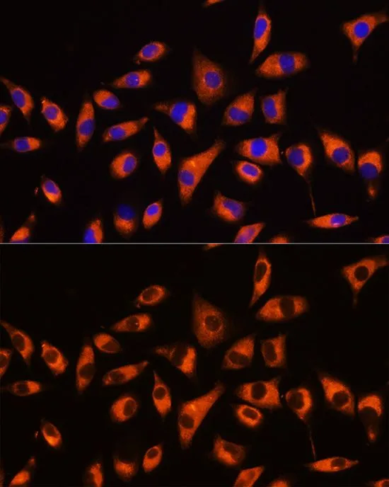 ICC/IF analysis of L929 cells using GTX66519 GNB2 antibody. Blue : DAPI Dilution : 1:100