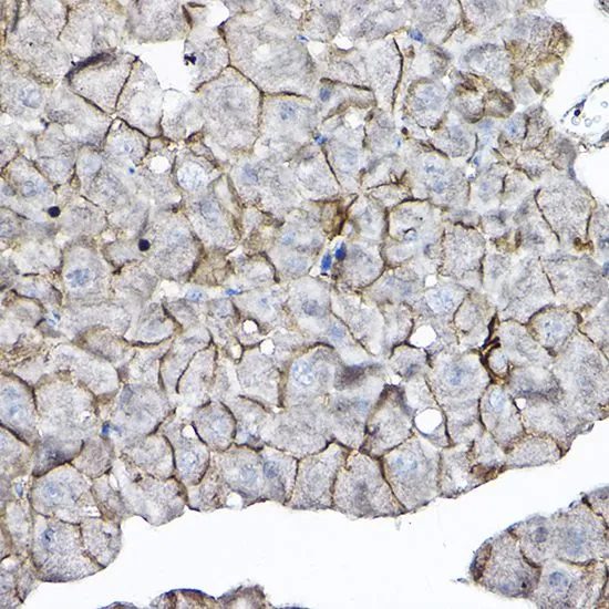 IHC-P analysis of mouse pancreas tissue using GTX66519 GNB2 antibody. Dilution : 1:100