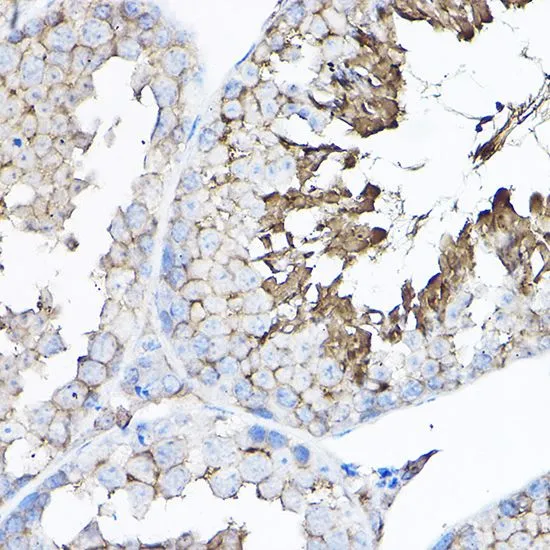 IHC-P analysis of mouse testis tissue using GTX66519 GNB2 antibody. Dilution : 1:100