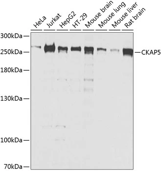 WB analysis of various sample lysates using GTX66531 CKAP5 antibody. Dilution : 1:1000 Loading : 25microg per lane