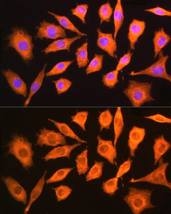 ICC/IF analysis of L929 cells using GTX66531 CKAP5 antibody. Blue : DAPI Dilution : 1:100