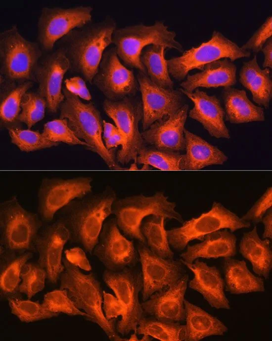 ICC/IF analysis of U2OS cells using GTX66531 CKAP5 antibody. Blue : DAPI Dilution : 1:100