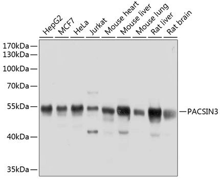 WB analysis of various sample lysates using GTX66537 PACSIN3 antibody. Dilution : 1:1000 Loading : 25microg per lane WB analysis of various sample lysates using GTX66537 PACSIN3 antibody. Dilution : 1:1000 Loading : 25microg per lane