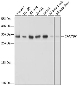 WB analysis of various sample lysates using GTX66541 CacyBP antibody. Dilution : 1:1000 Loading : 25microg per lane WB analysis of various sample lysates using GTX66541 CacyBP antibody. Dilution : 1:1000 Loading : 25microg per lane