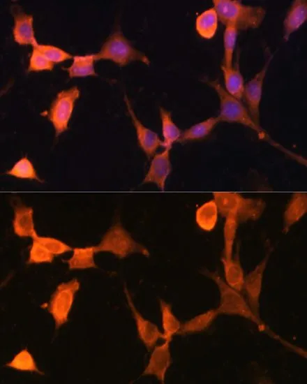 ICC/IF analysis of NIH/3T3 cells using GTX66541 CacyBP antibody. Blue : DAPI Dilution : 1:100