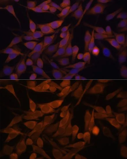 ICC/IF analysis of HeLa cells using GTX66541 CacyBP antibody. Blue : DAPI Dilution : 1:100