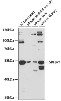 WB analysis of various sample lysates using GTX66544 SRFBP1 antibody. The signal was developed with ECL plus-Enhanced. Dilution : 1:3000 Loading : 25microg per lane WB analysis of various sample lysates using GTX66544 SRFBP1 antibody. The signal was developed with ECL plus-Enhanced. Dilution : 1:3000 Loading : 25microg per lane