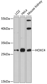 WB analysis of various sample lysates using GTX66549 HOXC4 antibody. The signal was developed with ECL plus-Enhanced. Dilution : 1:3000 Loading : 25microg per lane WB analysis of various sample lysates using GTX66549 HOXC4 antibody. The signal was developed with ECL plus-Enhanced. Dilution : 1:3000 Loading : 25microg per lane