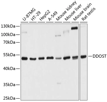 WB analysis of various sample lysates using GTX66551 OST48 antibody. Dilution : 1:1000 Loading : 25microg per lane WB analysis of various sample lysates using GTX66551 OST48 antibody. Dilution : 1:1000 Loading : 25microg per lane