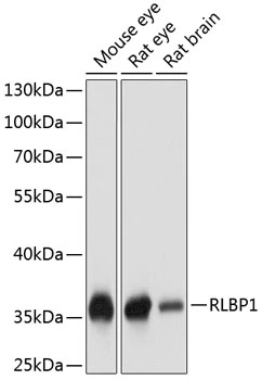 WB analysis of various sample lysates using GTX66554 CRALBP antibody. Dilution : 1:1000 Loading : 25microg per lane WB analysis of various sample lysates using GTX66554 CRALBP antibody. Dilution : 1:1000 Loading : 25microg per lane