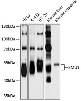 WB analysis of various sample lysates using GTX66555 SMU1 antibody. Dilution : 1:1000 Loading : 25microg per lane WB analysis of various sample lysates using GTX66555 SMU1 antibody. Dilution : 1:1000 Loading : 25microg per lane
