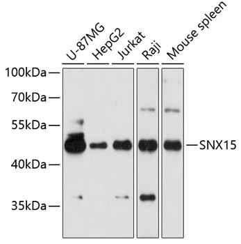 WB analysis of various sample lysates using GTX66558 SNX15 antibody. Dilution : 1:3000 Loading : 25microg per lane WB analysis of various sample lysates using GTX66558 SNX15 antibody. Dilution : 1:3000 Loading : 25microg per lane