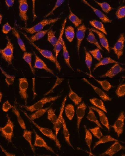 ICC/IF analysis of L929 cells using GTX66558 SNX15 antibody. Blue : DAPI Dilution : 1:100