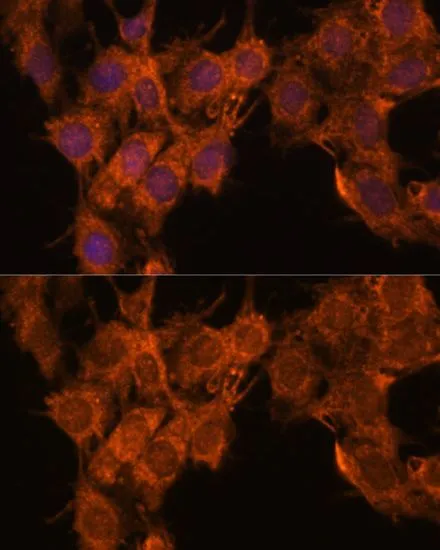ICC/IF analysis of C6 cells using GTX66558 SNX15 antibody. Blue : DAPI Dilution : 1:100