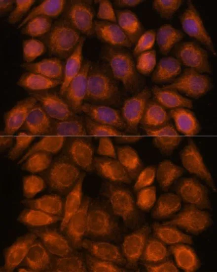 ICC/IF analysis of HeLa cells using GTX66558 SNX15 antibody. Blue : DAPI Dilution : 1:100