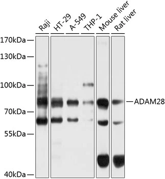 WB analysis of various sample lysates using GTX66574 ADAM28 antibody. Dilution : 1:1000 Loading : 25microg per lane WB analysis of various sample lysates using GTX66574 ADAM28 antibody. Dilution : 1:1000 Loading : 25microg per lane