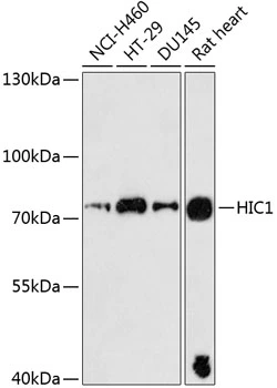 WB analysis of various sample lysates using GTX66577 HIC1 antibody. Dilution : 1:3000 Loading : 25microg per lane WB analysis of various sample lysates using GTX66577 HIC1 antibody. Dilution : 1:3000 Loading : 25microg per lane