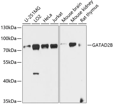 WB analysis of various sample lysates using GTX66580 p66 beta antibody. Dilution : 1:1000 Loading : 25microg per lane WB analysis of various sample lysates using GTX66580 p66 beta antibody. Dilution : 1:1000 Loading : 25microg per lane